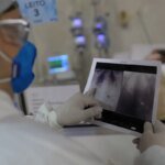 Broncopneumonia: entenda quadro que causou internação de Bolsonaro