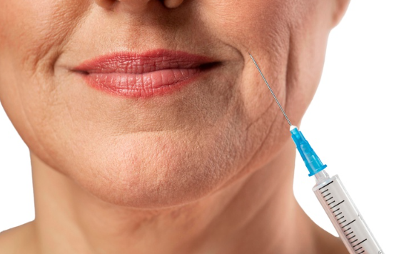 Riscos graves do uso indevido de preenchedores estéticos