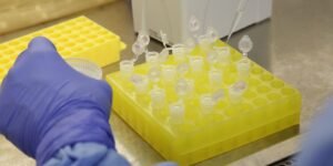 SP confirma segundo caso importado de sarampo