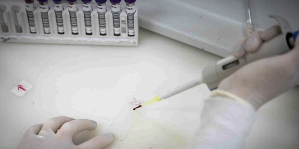 Exames descartam ebola em imigrante da República Democrática do Congo