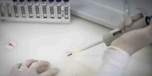 Exames descartam ebola em imigrante da República Democrática do Congo